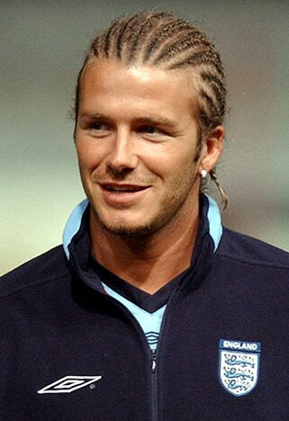 David Beckham Hair Transplant  Hair Loss  Technical Analysis